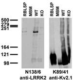 LRRK2/Dardarin Monoclonal Antibody (N138/6)