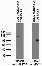 JMJD2A Monoclonal Antibody (N154/32)