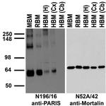 PARIS/ZNF746 Antibody in Western Blot (WB)