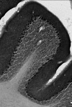 Navbeta4 Na+ Channel Antibody in Immunohistochemistry (Frozen) (IHC (F))