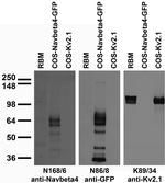 Navbeta4 Na+ Channel Antibody in Western Blot (WB)