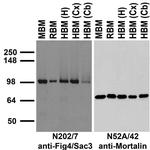 Fig4/Sac3 Antibody in Western Blot (WB)