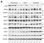 VDAC1 Antibody in Western Blot (WB)