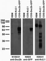 Doc2B Antibody in Western Blot (WB)