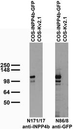 INPP4b Antibody in Western Blot (WB)