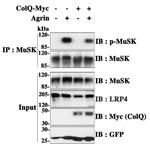 LRP4 (Extracellular) Antibody in Western Blot (WB)