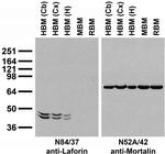 Laforin Monoclonal Antibody (N84/37)
