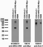 Neuregulin-CRD (Cysteine-Rich Domain/Type III) Monoclonal Antibody (N126B/31)