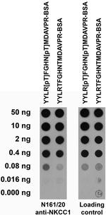 NKCC1 Monoclonal Antibody (N161/20)