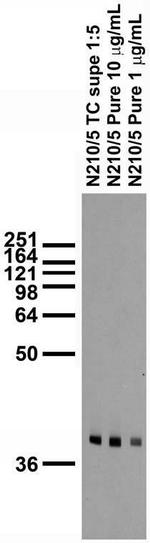 PhyH/PAHX Monoclonal Antibody (N210/5)