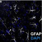 GFAP Antibody in Immunohistochemistry (Frozen) (IHC (F))
