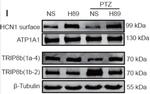 TRIP8b (Exon 1b) Antibody in Western Blot (WB)