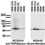 TRIP8b (Exon 1b) Antibody in Western Blot (WB)