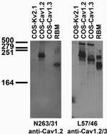 Cav1.2 Ca2+ Channel Antibody in Western Blot (WB)
