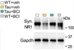 GluN1/NR1 Glutamate Receptor Antibody in Western Blot (WB)