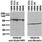 GluN1/NR1 Glutamate Receptor Antibody in Western Blot (WB)