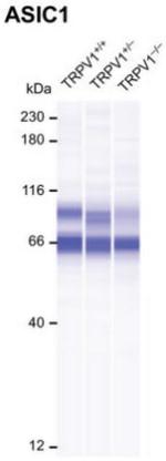 ASIC1 Antibody in Western Blot (WB)