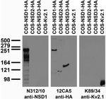 NSD1 Monoclonal Antibody (N312/10)