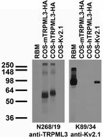 TRPML3/Mucolipin-3 Monoclonal Antibody (N268/19)
