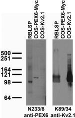 PEX6 Antibody in Western Blot (WB)