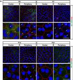 Arl13b Antibody in Immunocytochemistry (ICC/IF)