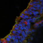 GluN2A/NR2A Monoclonal Antibody (N327/95)