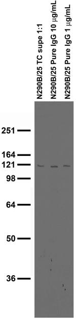 ARHGAP4 Monoclonal Antibody (N290B/25)