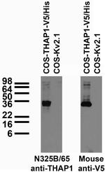 THAP1 Monoclonal Antibody (N325B/65)