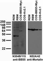 BBS5 Monoclonal Antibody (N304B/115)
