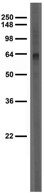 ATF4 Antibody in Western Blot (WB)