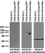 Kv2.2 Potassium Channel Monoclonal Antibody (N372B/60)