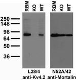 Kv4.2 Potassium Channel Antibody in Immunohistochemistry (Frozen) (IHC (F))