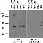 Kv4.2 Potassium Channel Antibody in Western Blot (WB)