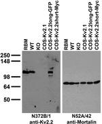 Kv2.2 Potassium Channel Monoclonal Antibody (N372B/1)
