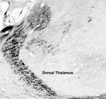 Beta1-Spectrin Antibody in Immunohistochemistry (Frozen) (IHC (F))