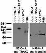 TRAK2 Monoclonal Antibody (N390/43)