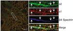 Beta4-Spectrin Antibody in Western Blot (WB)
