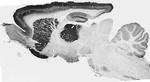 GABA-A-R-Alpha4 Antibody in Western Blot (WB)