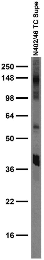 Thyroid Hormone Receptor Beta1 Antibody in Western Blot (WB)