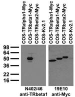 Thyroid Hormone Receptor Beta1 Monoclonal Antibody (N402/46)
