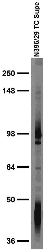 Navbeta3 Na+ Channel Monoclonal Antibody (N396/29)