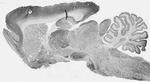 Kv3.2 Potassium Channel Antibody in Western Blot (WB)