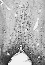 GABA-A-R-Epsilon Antibody in Western Blot (WB)