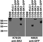 SK2 potassium channel Antibody in Western Blot (WB)