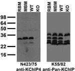 KChIP4 K+ channel Antibody in Western Blot (WB)