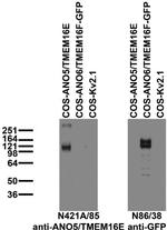 ANO5/TMEM16E Monoclonal Antibody (N421A/85)