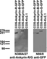 Ankyrin-R/G Antibody in Western Blot (WB)