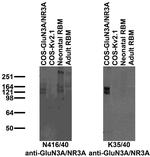 GluN3A/NR3A Antibody in Western Blot (WB)
