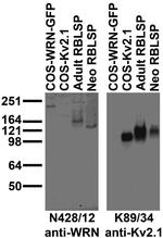 WRN Antibody in Western Blot (WB)