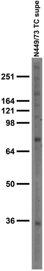 Slc18a2/VMAT2 Antibody in Western Blot (WB)